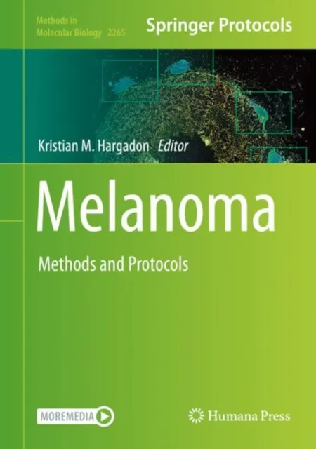 Melanoma