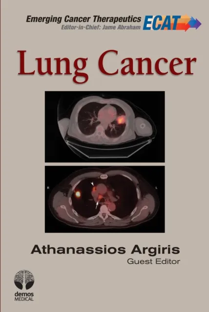 Lung Cancer