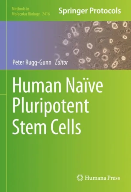 Human Naive Pluripotent Stem Cells