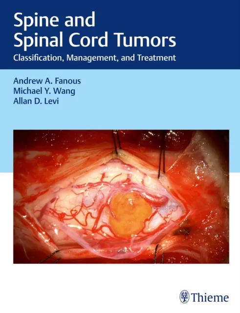 Spine and Spinal Cord Tumors
